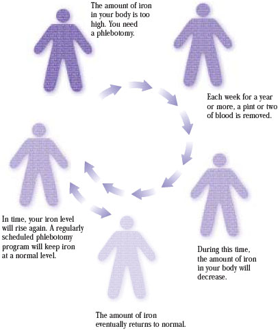 Graphic: Diagram of cycle of events which result from hemochromatosis 